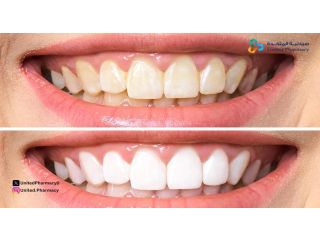 أفضل معجون أسنان للتبييض