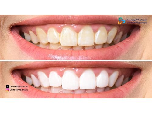 أفضل معجون أسنان للتبييض
