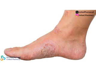 اسباب الحكة في الساقين وأهم طرق التشخيص والعلاج