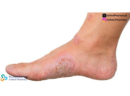 اسباب الحكة في الساقين وأهم طرق التشخيص والعلاج