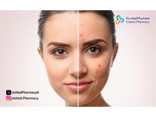 كريم فيوسيدين لآثار الحبوب