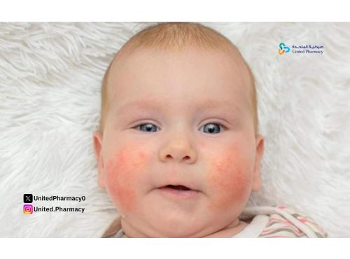 هل كريم فيوسيدين مناسب للاطفال