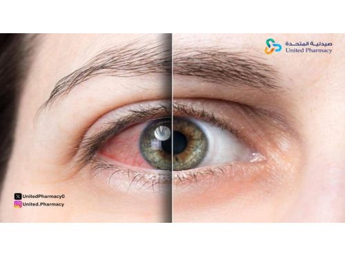 هل جفاف العين خطير