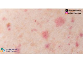  أسباب ظهور نقط حمراء في الجسم وكيفية التعامل الصحيح معها