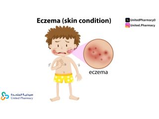 أعراض الطفح الجلدي وكيفية علاجها بشكل نهائي