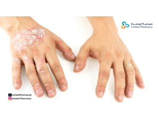  أسرع كريم لعلاج الصدفية