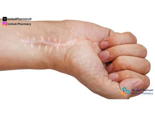 أفضل جل سيليكون للندبات للتخلص من آثارها على الجلد نهائياً