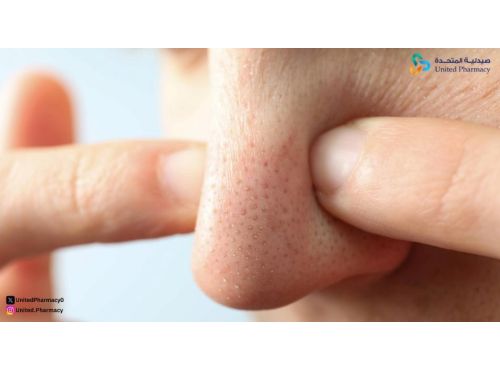 علاج المسامات من الصيدلية