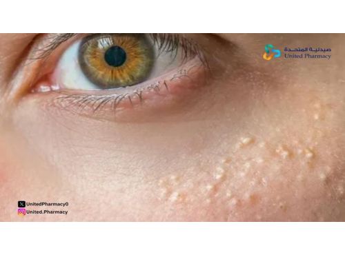 علاج الحبوب الصغيرة تحت الجلد في الوجه