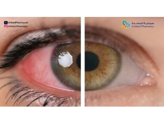 متى يكون التهاب العين خطير