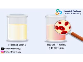 نزول دم مع البول عند المرأة