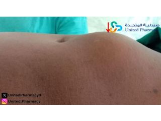 أعراض الفتق عند النساء