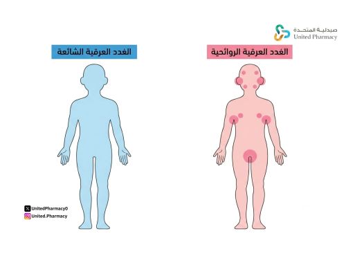 الغدد العرقية