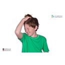 أعراض القمل