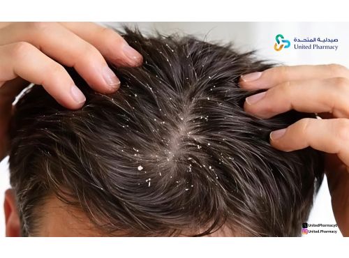 العلاقة بين القشرة وتساقط الشعر