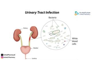 مضادات التهاب البول
