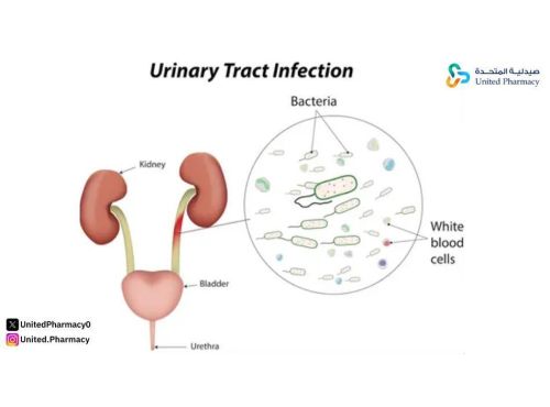مضادات التهاب البول