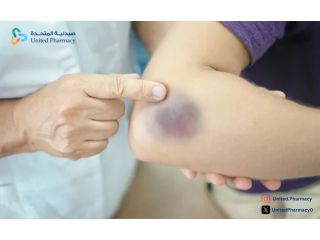 ما هي اسباب ظهور كدمات في الجسم بدون سبب​