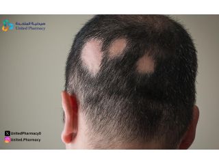 ما هي الثعلبة