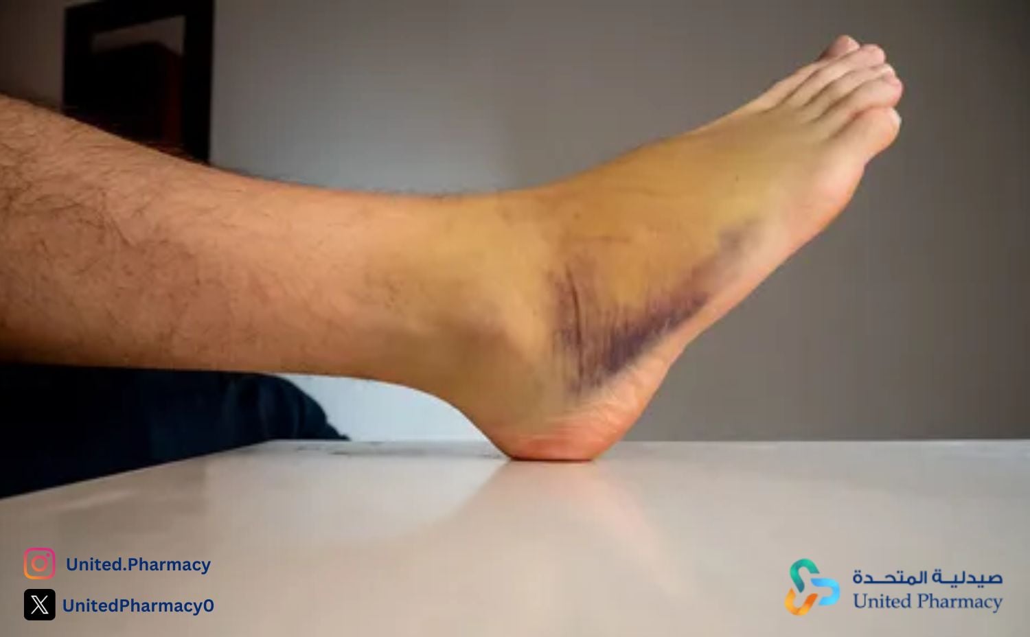 ظهور كدمات في الجسم بدون سبب عند الأطفال