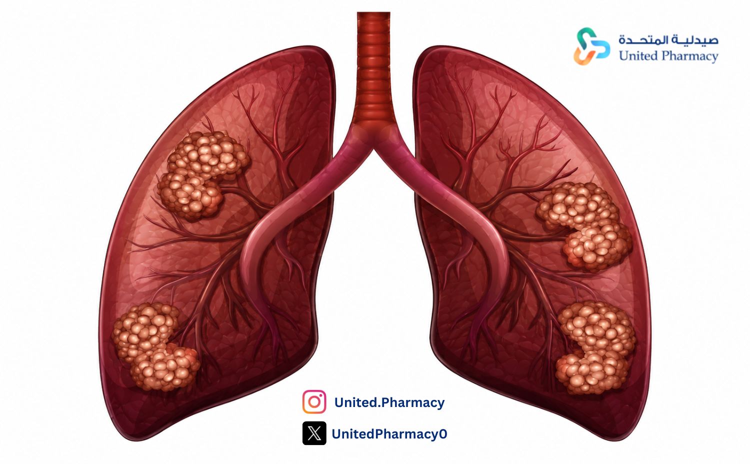 أول علامات السرطان