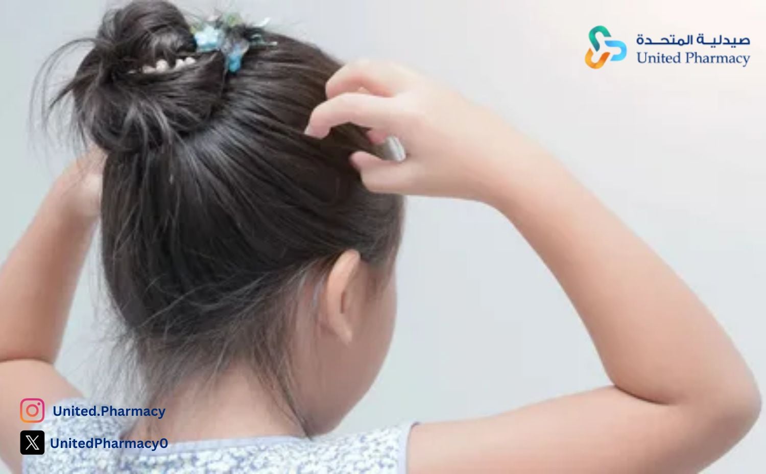علاج صيبان الشعر للأطفال