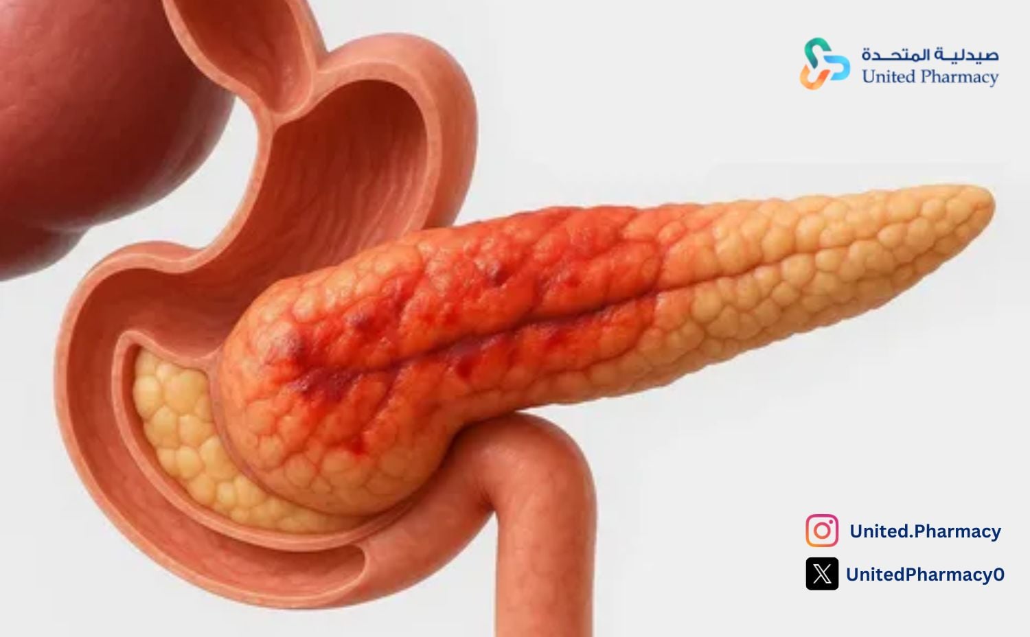 أعراض التهاب البنكرياس عند النساء