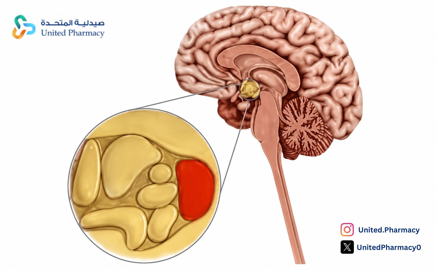 الغدة تحت المهاد