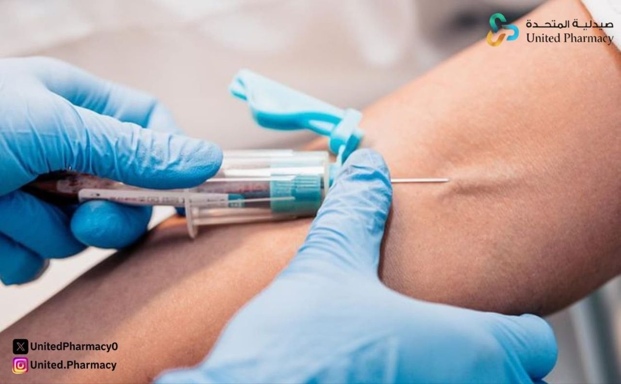 amyloid A protein نسبة تحليل