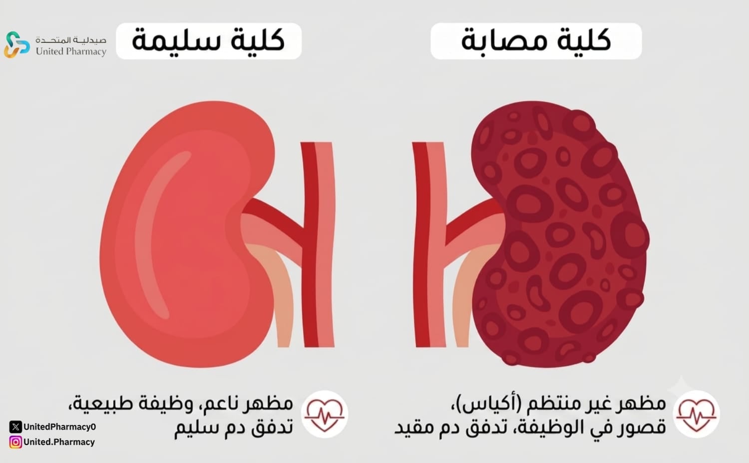 مرض الكلى المزمن