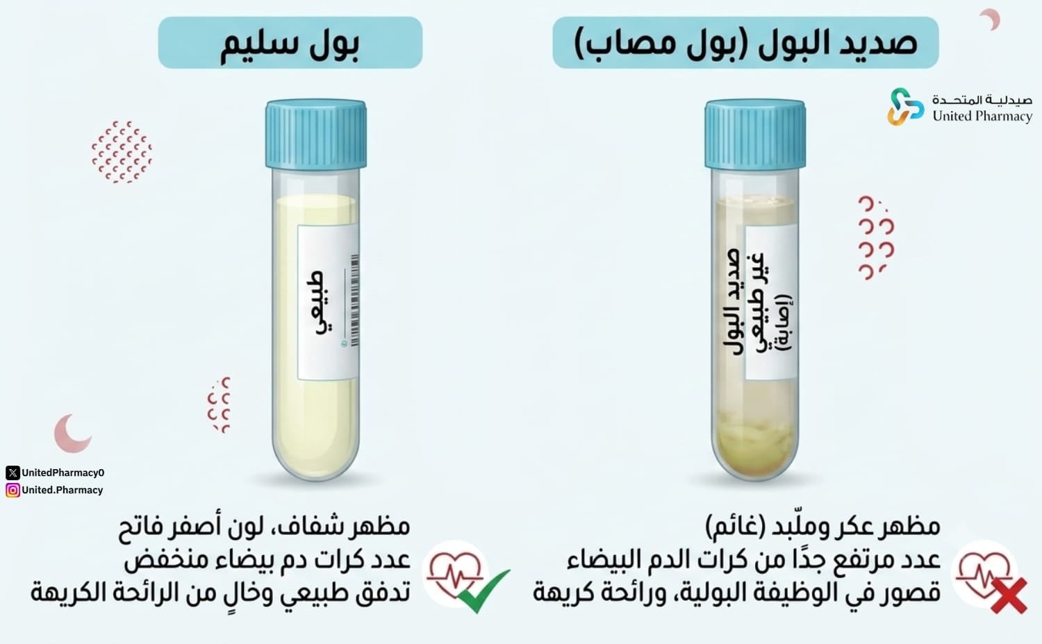 تشخيص صديد البول