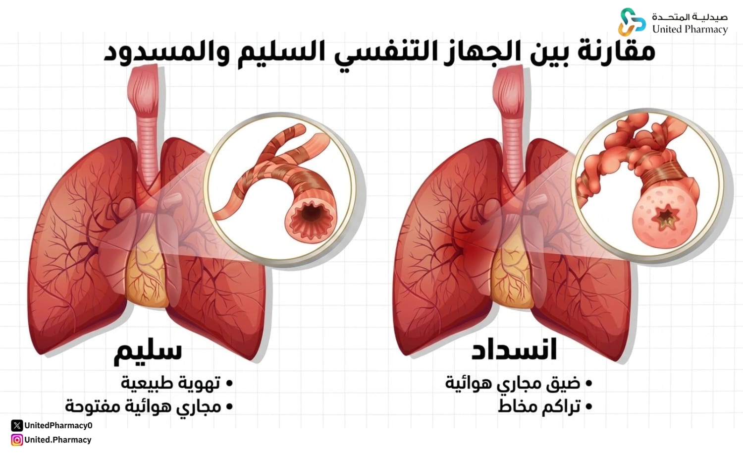 الوقاية من الانسداد الرئوي