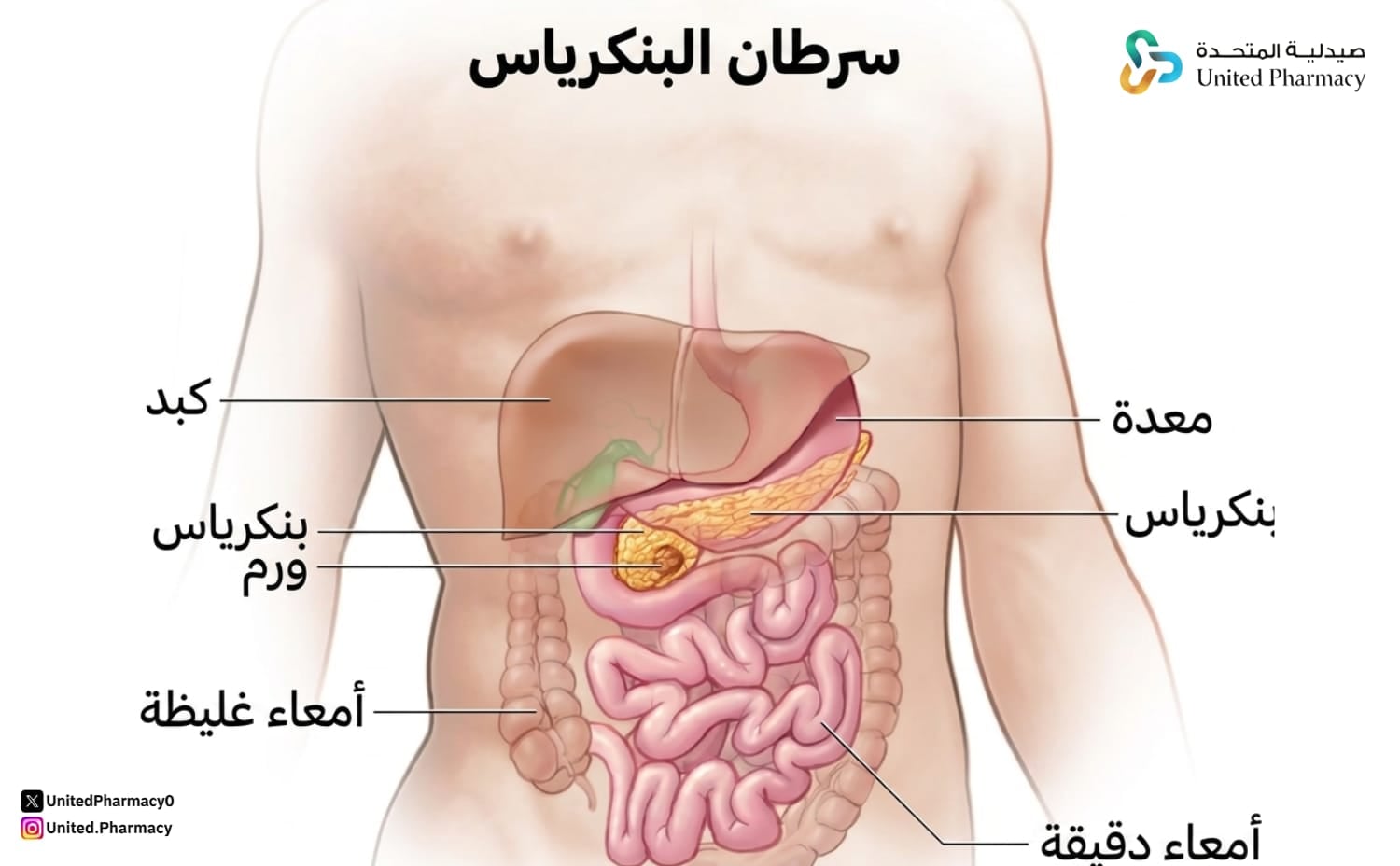 اعراض سرطان البنكرياس