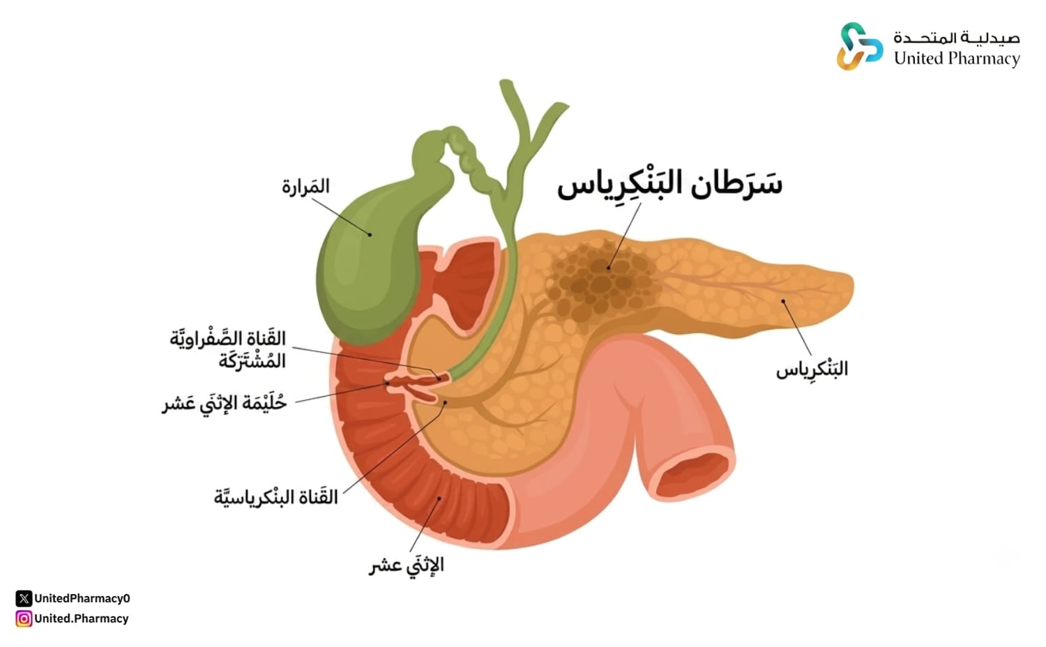 الوقاية من سرطان البنكرياس