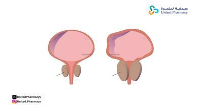 بديل اومنك اوكاس بديل اومنك اوكاس