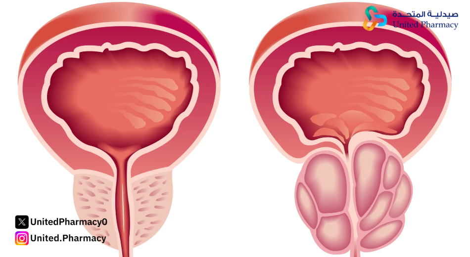 هل تامسولين يؤثر على الكلى؟ هل تامسولين يؤثر على الكلى؟