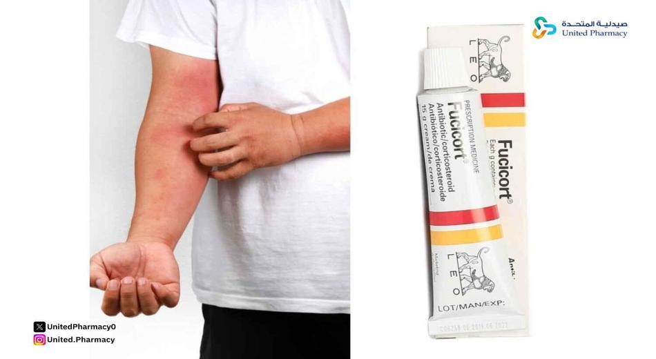 كريم فيوسيكورت للوجة