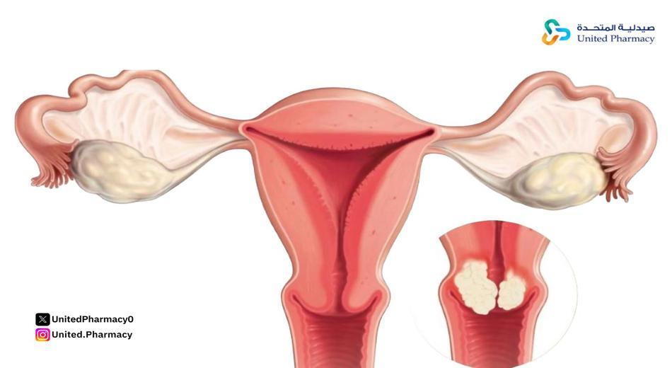 كيف احط كريم داخل المهبل؟