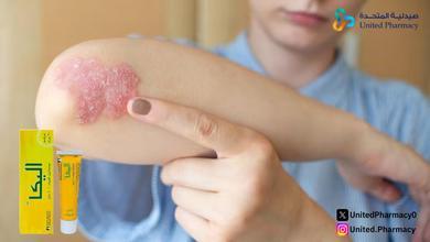 كريم اليكا للتصبغات