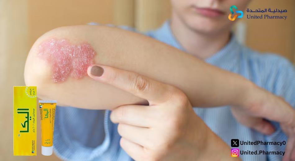 كريم اليكا للتصبغات