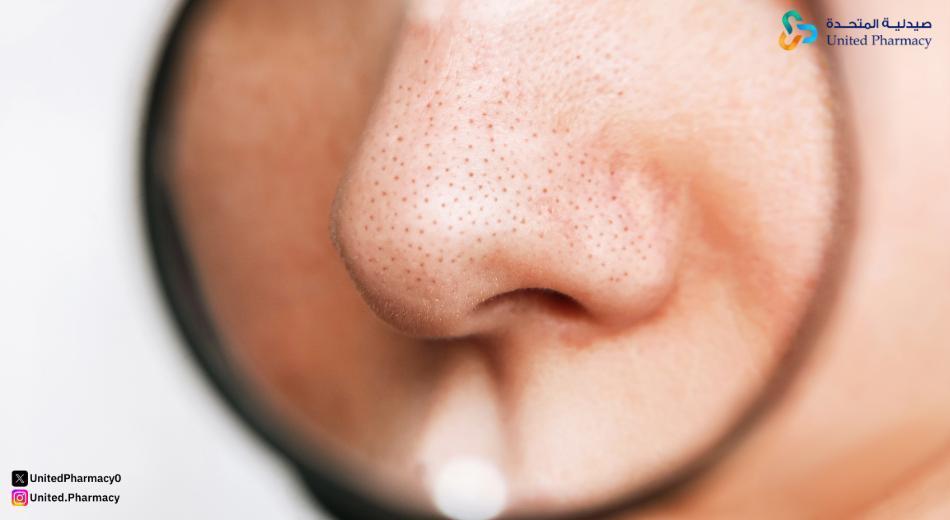 هل يوجد حل نهائي للمسام؟