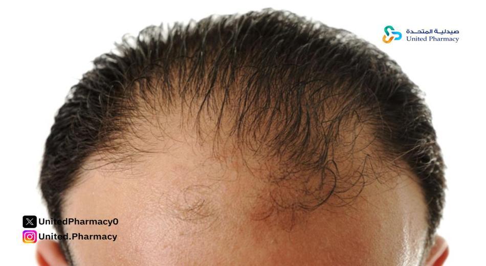 شامبو لمنع تساقط الشعر للرجال شامبو لمنع تساقط الشعر للرجال