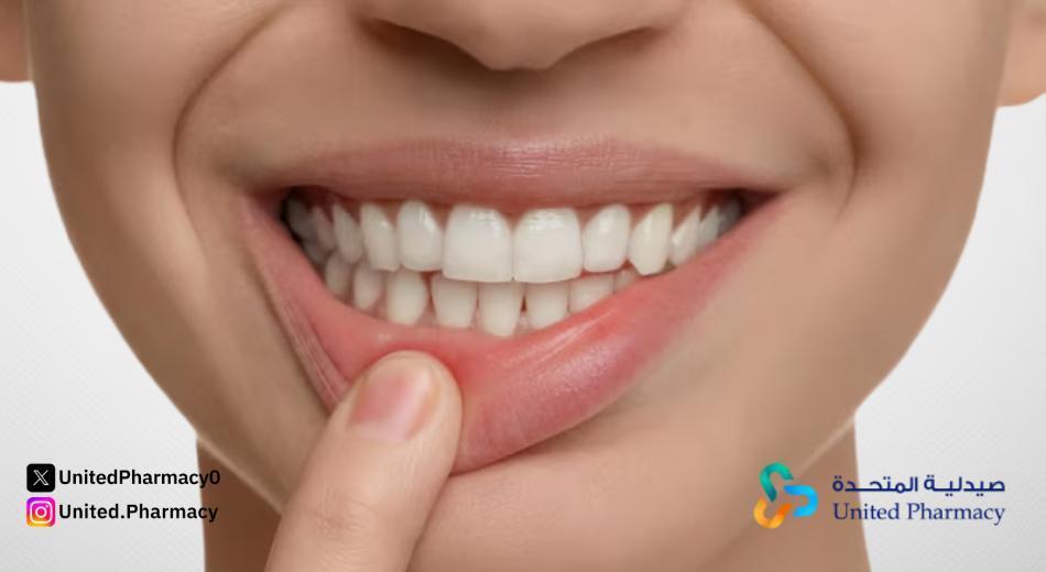 علاج التهاب اللثة سريع المفعول علاج التهاب اللثة سريع المفعول